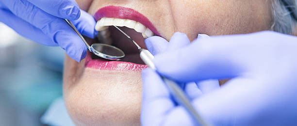 Best Emergency Dental Extractions in Taylor, PA